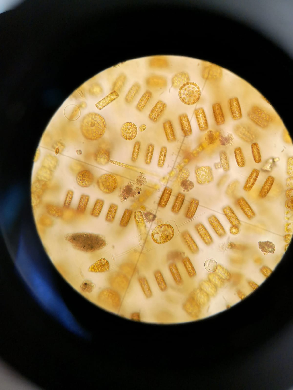 Phytoplankton under microscope (NIOZ)