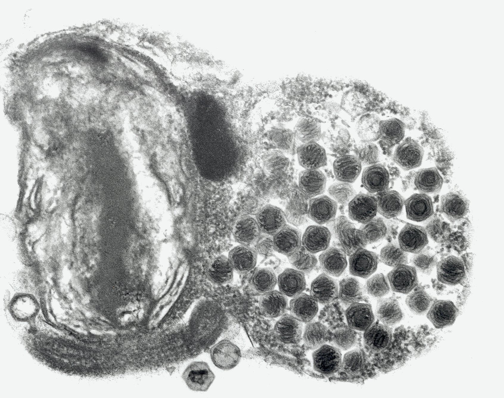 Elektronmicroscope image of virus-infected phytoplankton cell