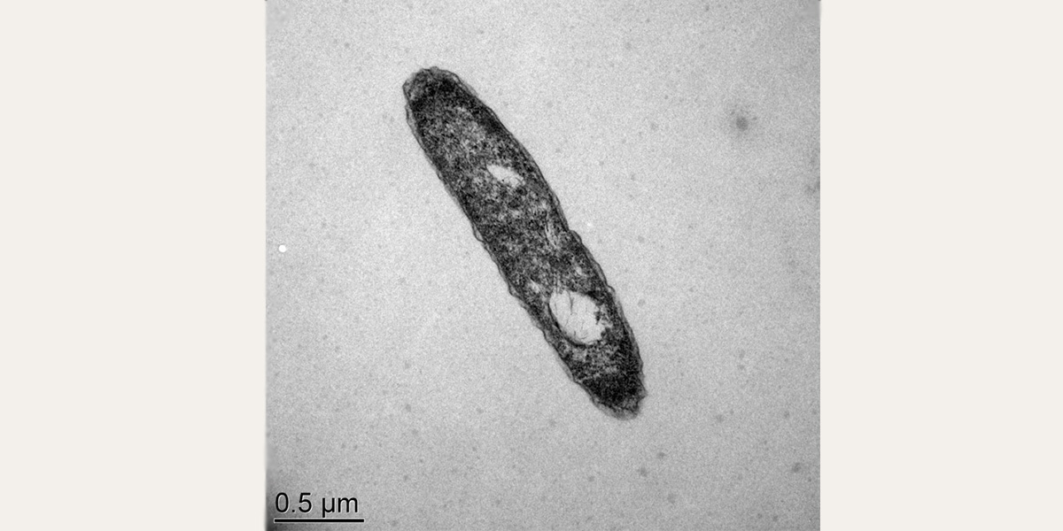 A microscopic image of the deap sea microbe Desulfatibacillum alkenivorans.